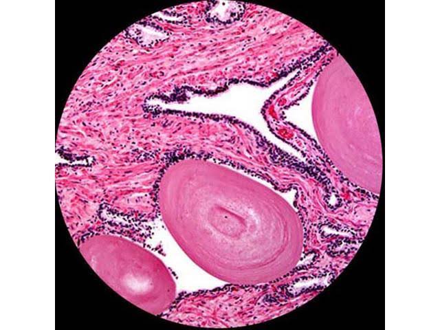 40X-2000X LED Monocular Compound Microscope with Mechanical Stage and Digital Camera R30800